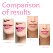 Fade And Smooth Fine Lines Of Lips Nourishing Moisturizing Lip Care Oil Beauty Supplies - My Store