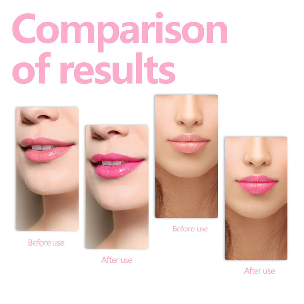 Fade And Smooth Fine Lines Of Lips Nourishing Moisturizing Lip Care Oil Beauty Supplies - My Store